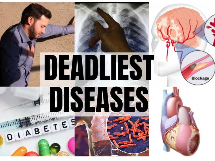 Top 10 deadliest diseases in the world  World - Gulf News