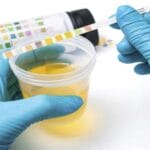 Urine infection: If the color of urine appears like this, take care immediately!  Do this quickly